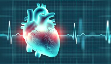 Study: Diabetes and sudden cardiac death: a Danish nationwide study. Image Credit: Yurchanka Siarhei / Shutterstock