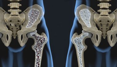 Study: The relationship between serum total alkaline phosphatase and risk of osteoporosis: a cross-sectional study. Image Credit: Javier Regueiro / Shutterstock