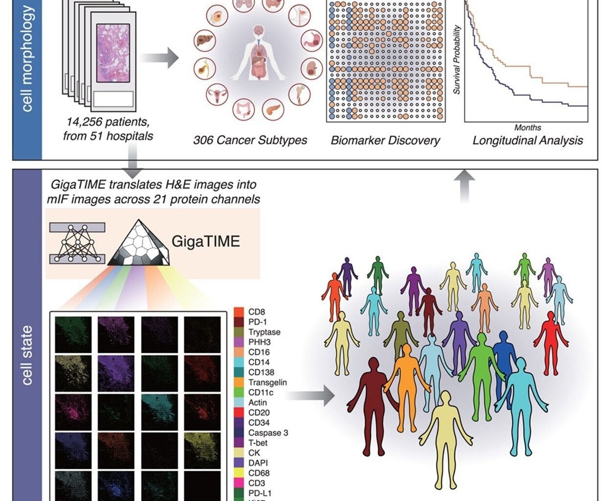 AI turns routine pathology slides into powerful maps of the tumor immune landscape