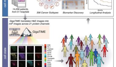 AI turns routine pathology slides into powerful maps of the tumor immune landscape