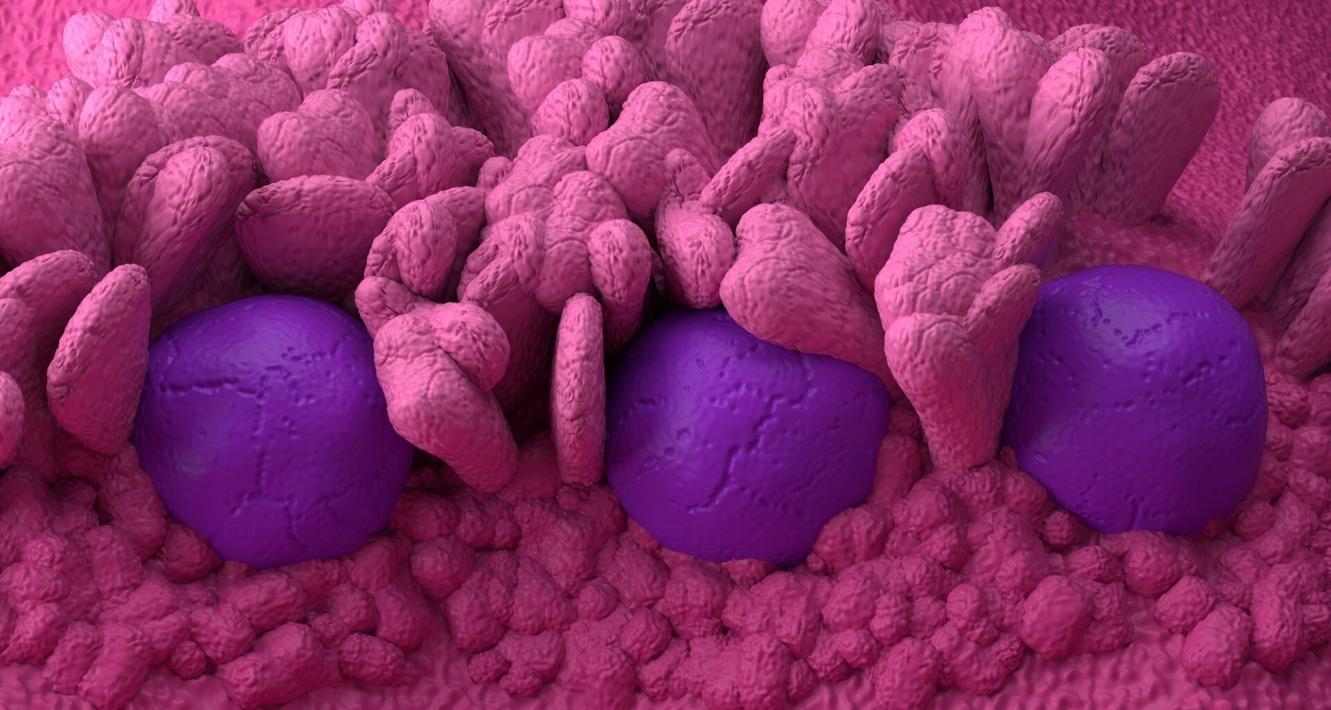 New findings show why the human intestine uniquely presents gluten to T cells