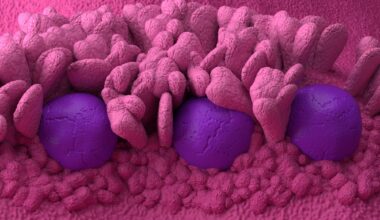 New findings show why the human intestine uniquely presents gluten to T cells