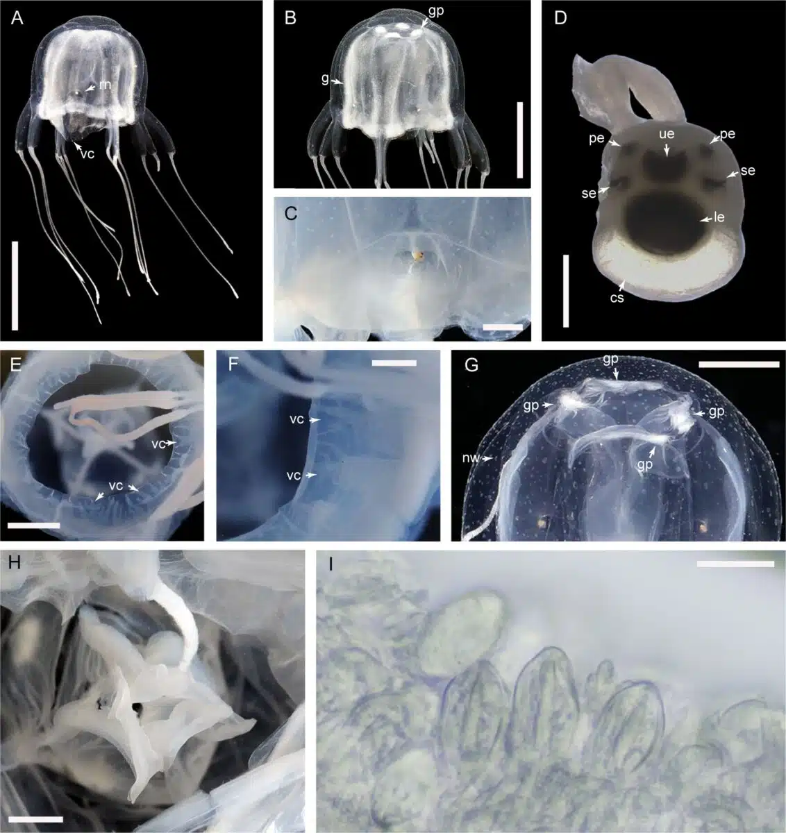 Morphological Features And Evolutionary Placement Of Tripedalia Maipoensis