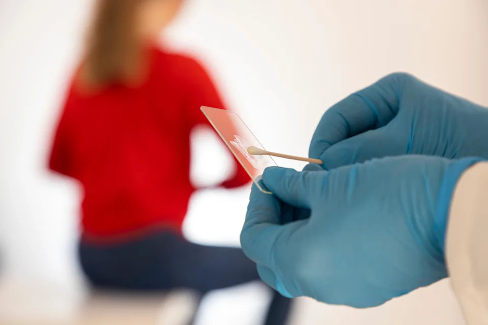 A doctor holding a cervical smear test sample
