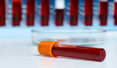 5 biomarkers that can predict your lifespan