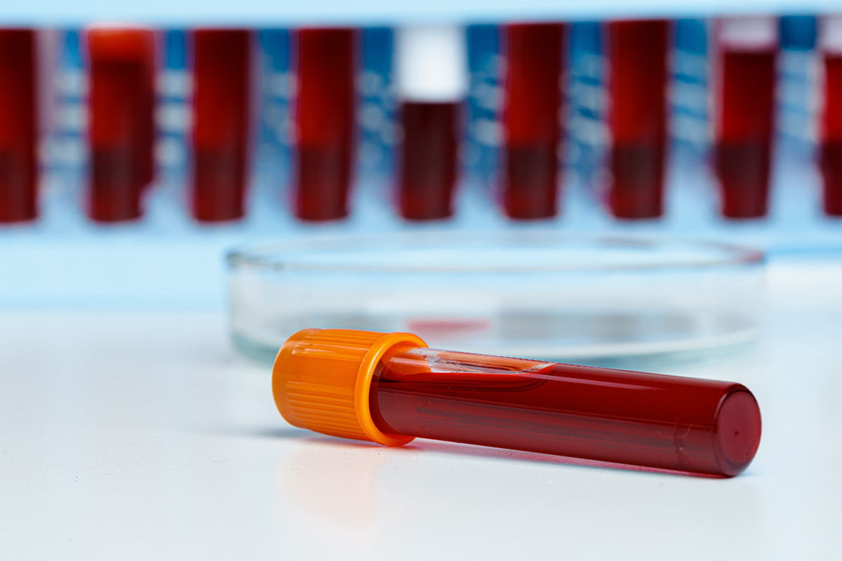 5 biomarkers that can predict your lifespan