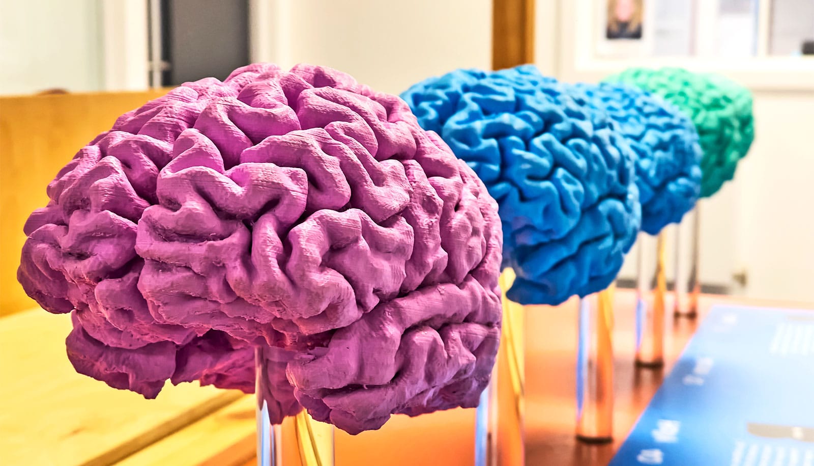 Team discovers molecular difference in brains of people with autism