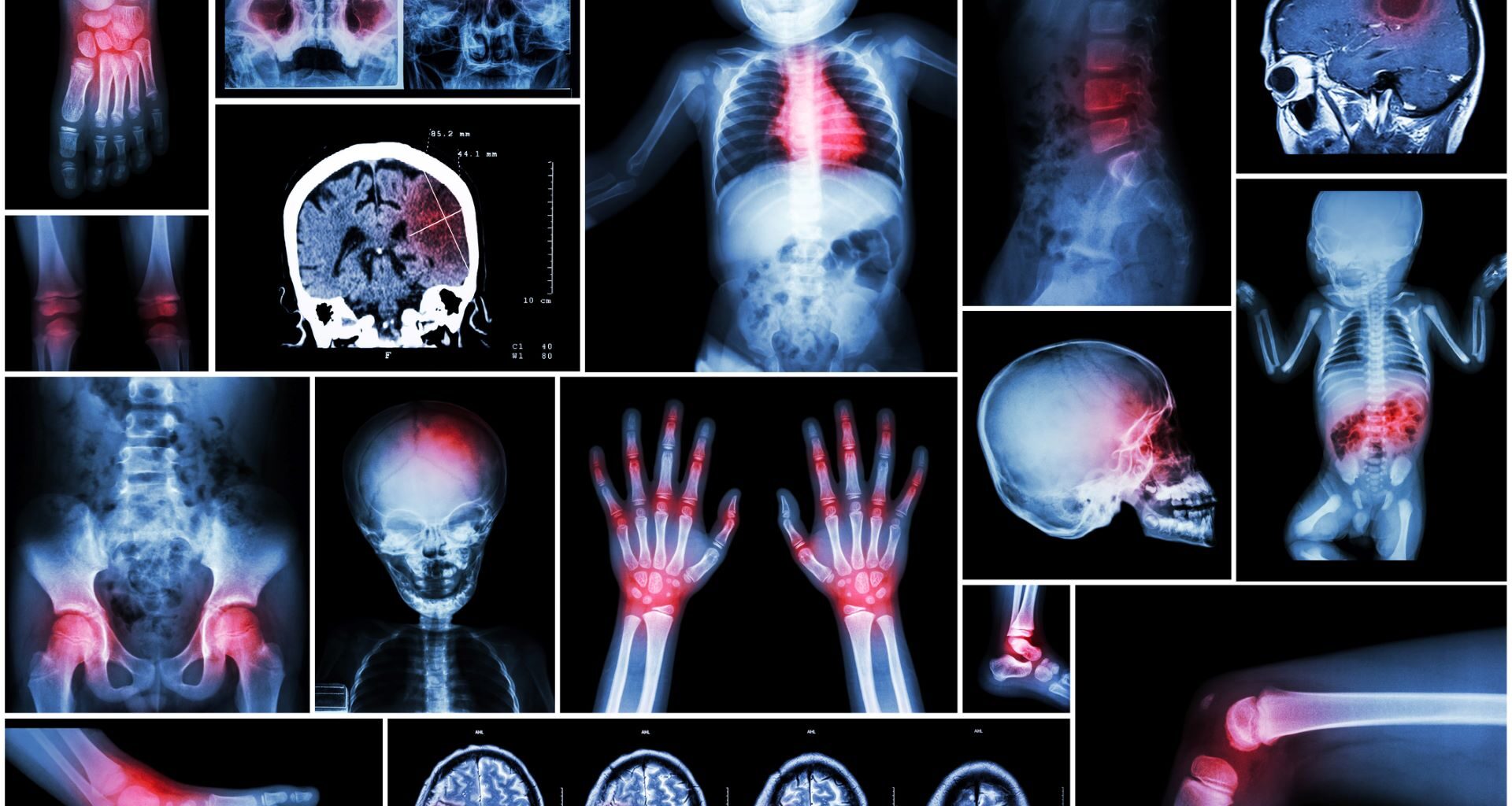 Prenatal exposure to air pollution may impact newborns’ brain development, according to new research from Barcelona.