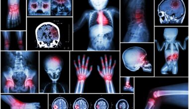 Prenatal exposure to air pollution may impact newborns’ brain development, according to new research from Barcelona.