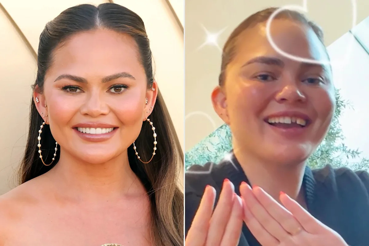 Chrissy Teigen knocks out dental veneer in candy cane game mishap: 'I was trying to create magic'