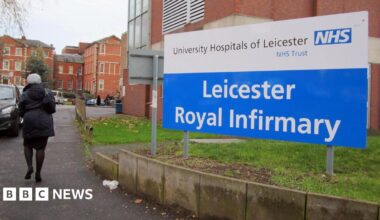 Dr Sanjeev Pattni, a consultant Gastroenterologist and co-head of service at Leicestershire's Hospitals, showing a nurse the endoscopy equipment in a medical room.