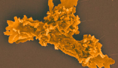 Extreme 'Fire Amoeba' Smashes Record For Heat Tolerance : ScienceAlert