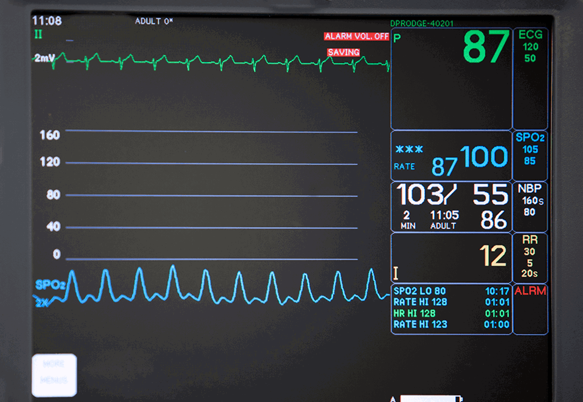 Advancement in assisted reproductive technology: Mitochondrial donation