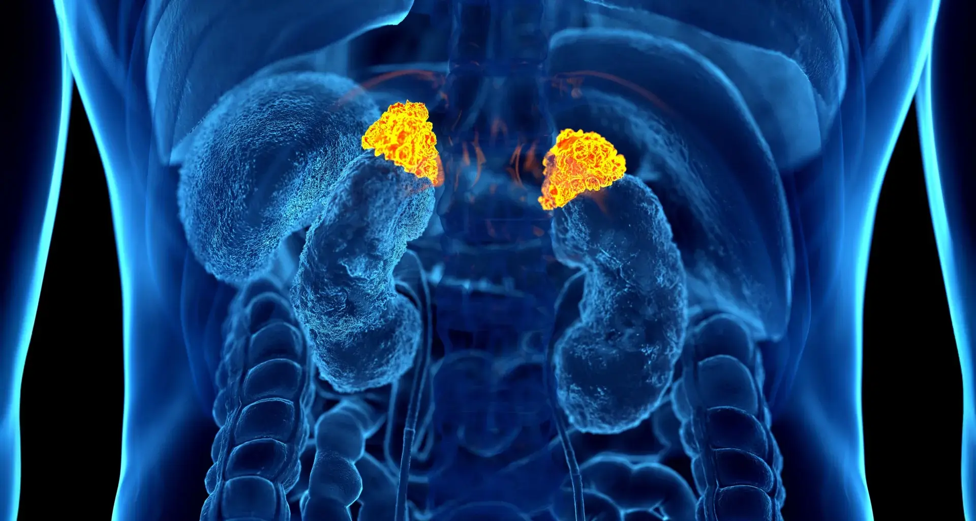 AI finds a hidden stress signal inside routine CT scans