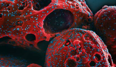 Co-Infections May Fuel Long COVID