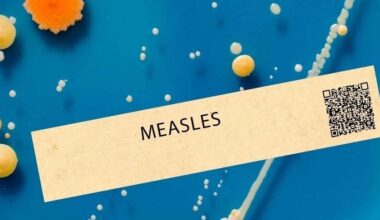 Possible Measles Exposure At Newark Airport Amid Holiday Travel: Health Officials