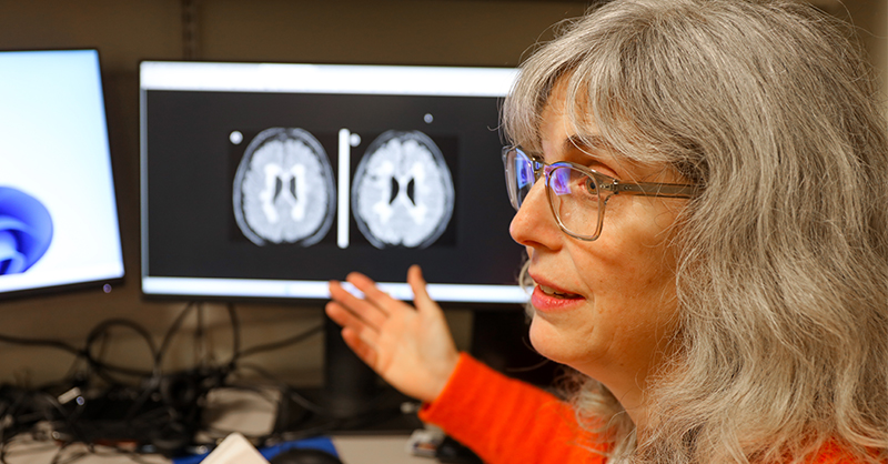 Mixed results in using lipoic acid to treat progressive multiple sclerosis