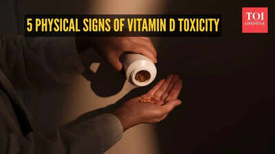 5 physical signs of vitamin D toxicity you should know