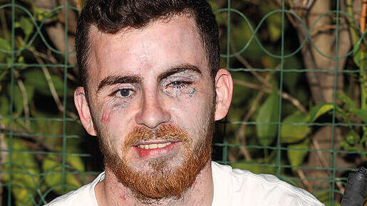 'The injury isn’t just our personal story, it’s the story of the entire nation'