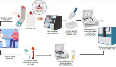 Finger-Prick Blood Test Accurately Measures Alzheimer’s Biomarkers