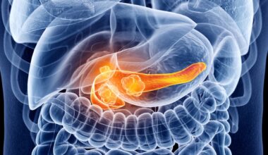 Multiantigen-Targeted T Cells Safe/Feasible in Locally Advanced PDAC