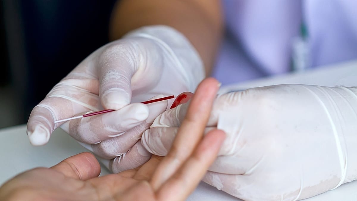 New finger-prick blood test could help detect Alzheimer's from a home-collected sample