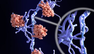 Scientists used AI to uncover two new biological subtypes of multiple sclerosis