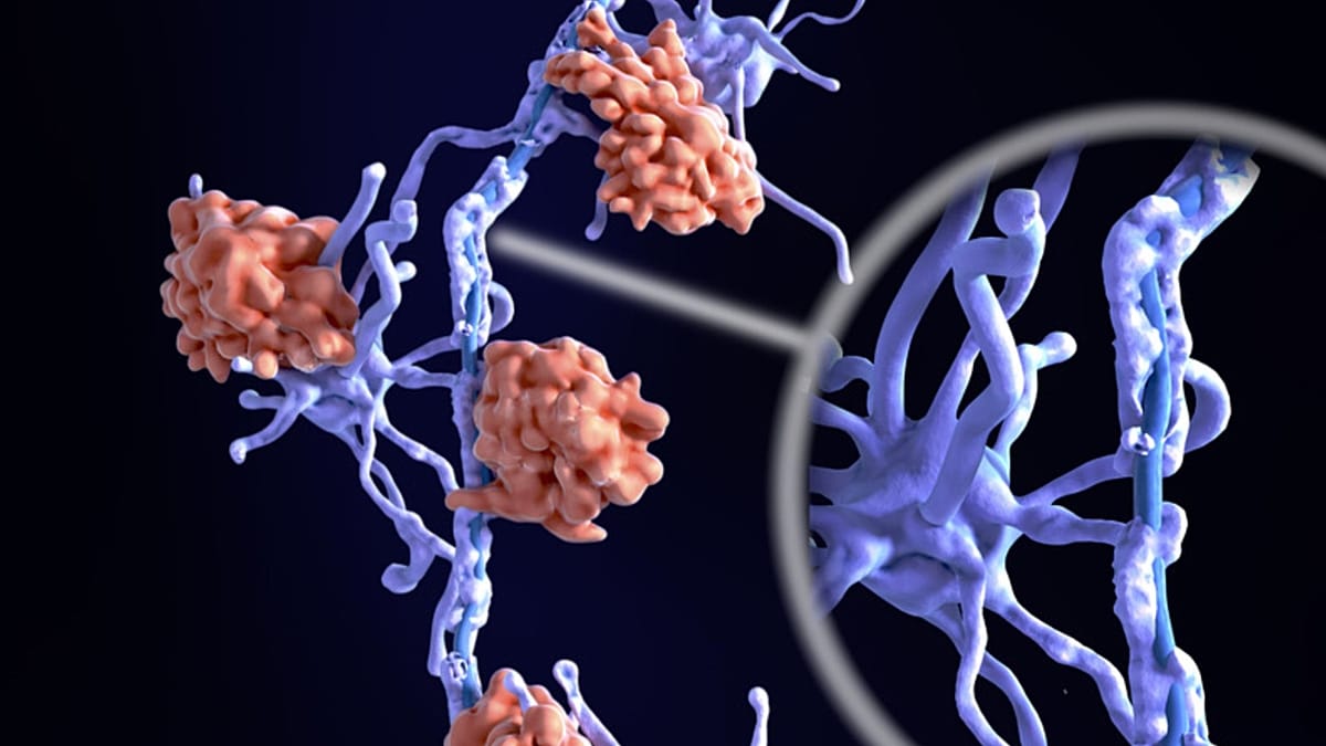 Scientists used AI to uncover two new biological subtypes of multiple sclerosis