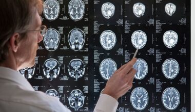 Why do some brains adapt to change faster than others? New study offers clues