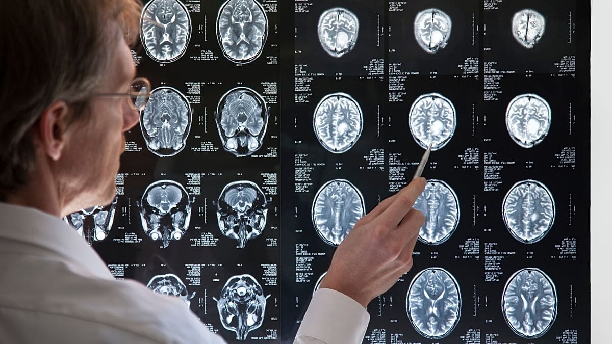 Why do some brains adapt to change faster than others? New study offers clues