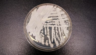 Drug-Resistant Fungus Candida Auris Spreads Globally as Researchers Seek New Treatments
