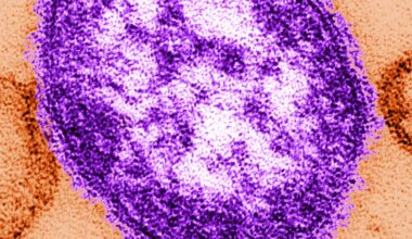 Oregon health officials confirm first measles cases of 2026