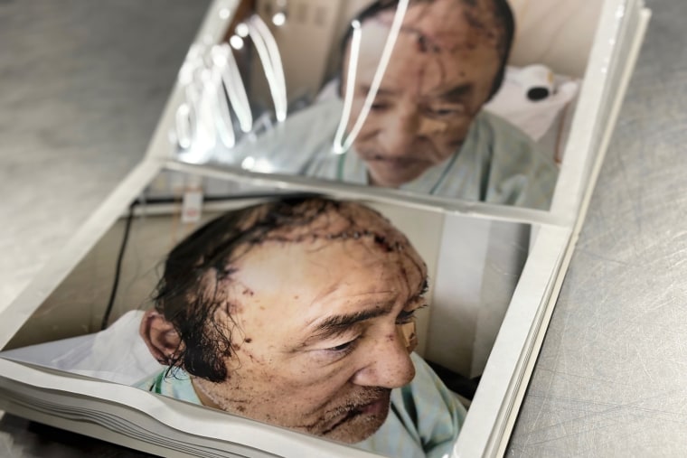 Photographs of Keiji Minatoya in the hospital a few days after the bear attack in October 2023 show the injuries to his head and face.