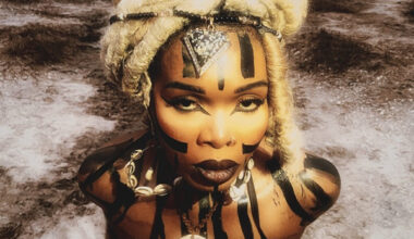 'People called me a witch for having 12 toes'