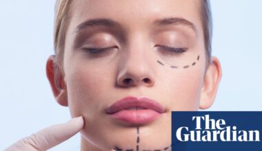 NHS spending up to £19k a time treating people suffering after overseas surgery, research finds | NHS