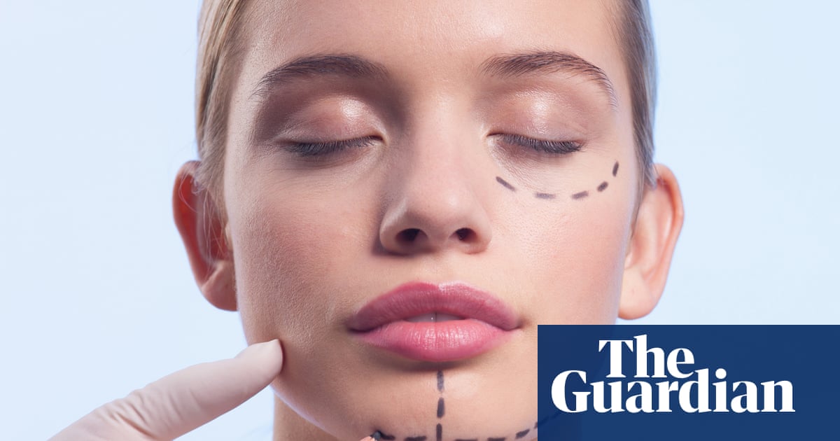 NHS spending up to £19k a time treating people suffering after overseas surgery, research finds | NHS