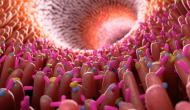 Gut Inflammation Link to Alzheimer's Disease Confirmed Once Again : ScienceAlert