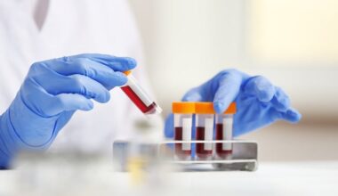 PSA Derivatives to Reduce Unnecessary Prostate MRI