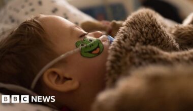 Surge in children with respiratory virus in Hull