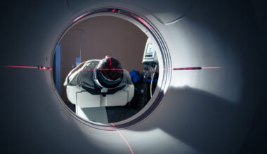 FDA clears AI to detect 14 conditions from CT. What’s next? - statnews.com