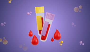 Blood test predicts advanced breast cancer treatment response before therapy begins