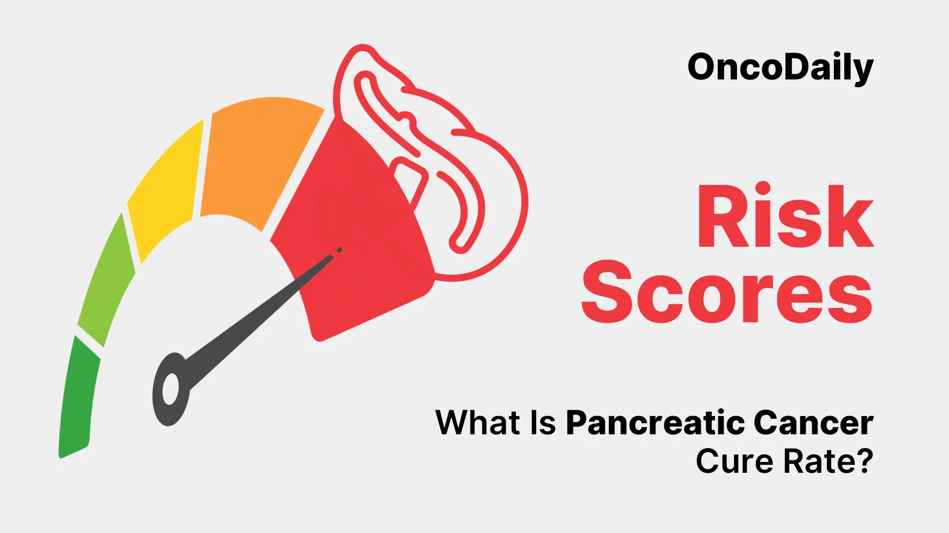 NanoKnife Success Rate for Pancreatic Cancer