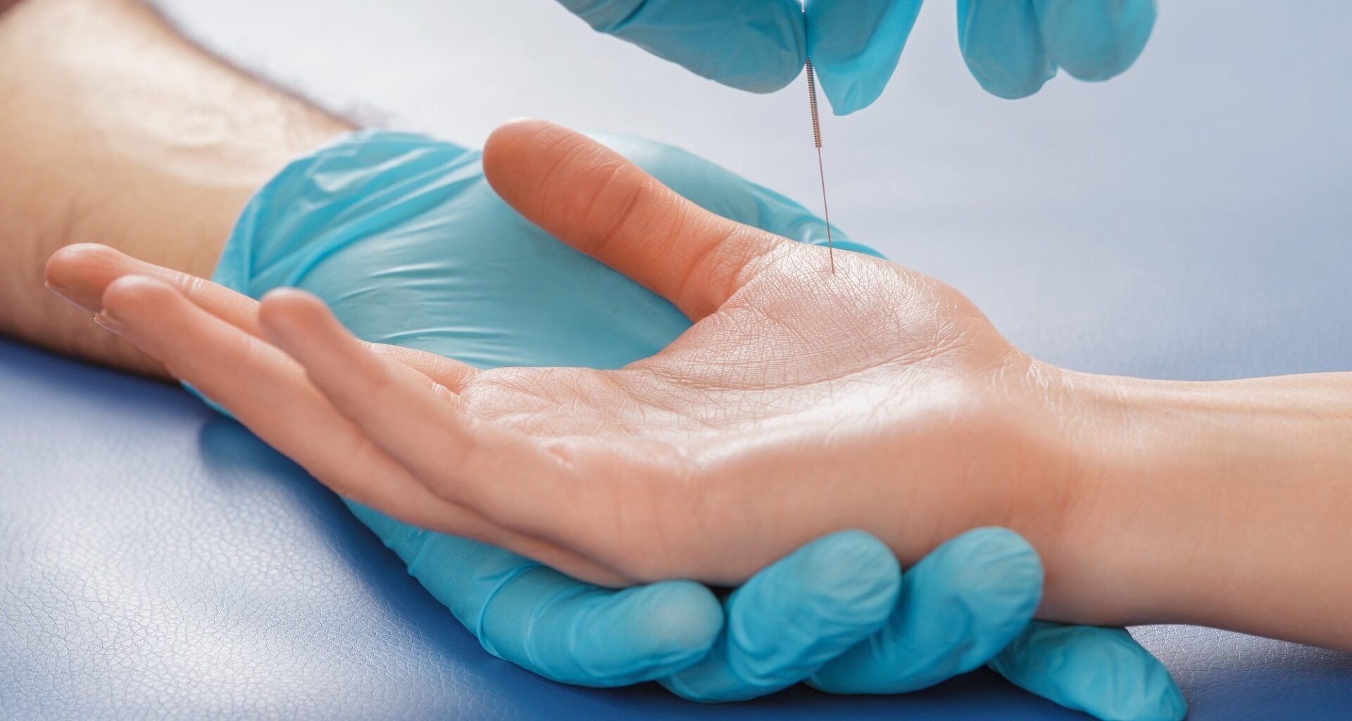 Acupuncture treatment on a patient