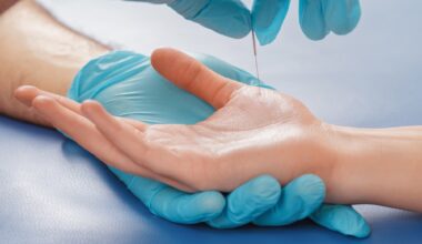 Acupuncture treatment on a patient