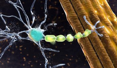 Study: Long-Term Exposure to Air Pollution and Risk and Prognosis of Motor Neuron Disease. Image Credit: Kateryna Kon / Shutterstock