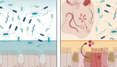 A protein found in the GI tract can neutralize many bacteria | MIT News