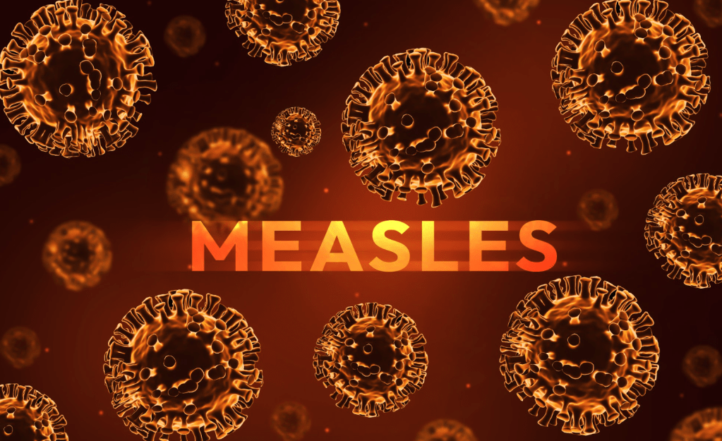 Health officials confirm measles case in Polk County