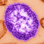 FILE - This undated image made available by the Centers for Disease Control and Prevention on Feb. 4, 2015 shows an electron microscope image of a measles virus particle, center.