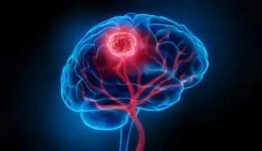 Brain cancer may begin years before doctors can see it