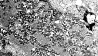 Rabies outbreak confirmed in Hays County